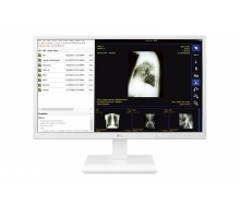 24'' FHD тонкий клиент для медицинских учреждений